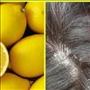 How to get rid of Dandruff naturally? 